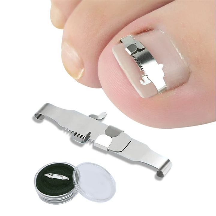 Ingrown%20toenail%20corrector%20Tools%20Pedicure%20Recover%20Embed%20Toe%20Nail%20Treatment%20professional%20Ingrown%20toenail%20correction%20Foot%20Care%20Tool%20-%20Image%202