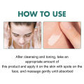 Melasma Removal Cream Niacinamide Brightening Reduce Melanin Facial Cream Lighten Dark Skin Shrink Pores Moisturizer Skin Care. 