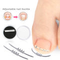 1PCS Ingrown Toenail Correction Tool Invisible Ingrown Toe Nail Elastic Straightening Clip Brace Pedicure Tool MIRRORRR. 