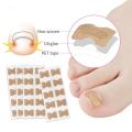 Ingrown Toenail Corrector Stickers Paronychia Treatment Pedicure Toe Nail Care Corrector Patch Correction Stickers 10-50Pcs. 