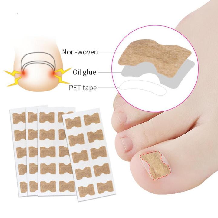 Ingrown Toenail Corrector Stickers Paronychia Treatment Pedicure Toe Nail Care Corrector Patch Correction Stickers 10-50Pcs