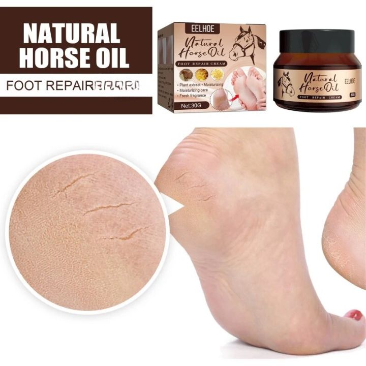 foot%20cream%20repair%20dry%20cracked%20heel%20peeling%20remove%20callus%20Dead%20skin%20exfoliating%20feet%20skin%20hydrating%20nourishing%20care%20-%20Image%203