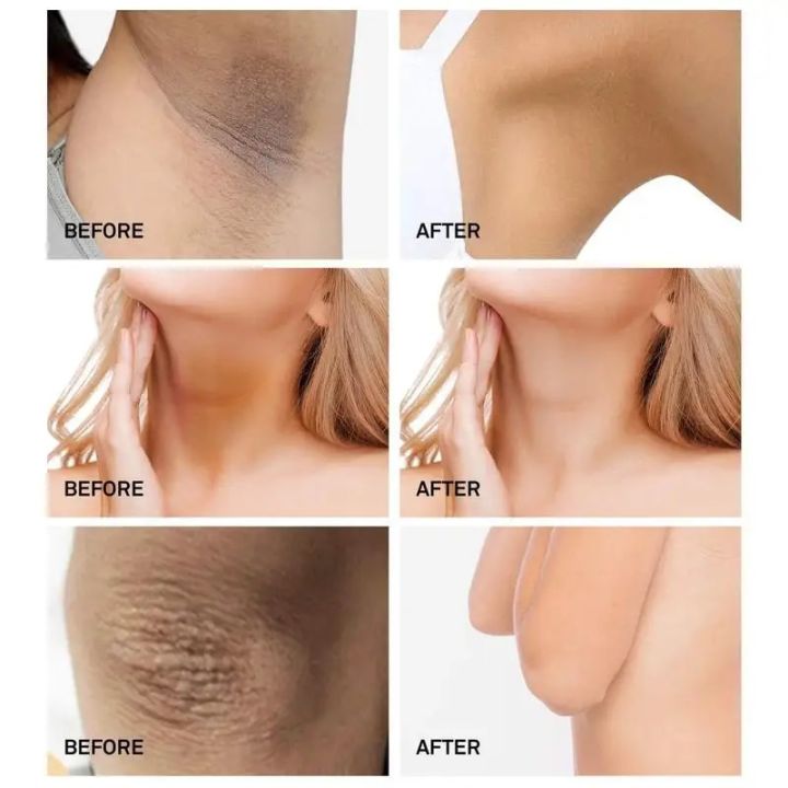 Whitening%20Cream%20Bleaching%20Cream%20for%20Dark%20Skin%20Private%20Parts%20Sensitive%20Area%20Armpit%20Neck%20Knees%20Elbow%20Melanin%20Brightening%20Body%20Care%20-%20Image%202