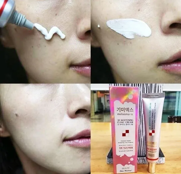 Beaute%20Melasma-X%203D%20Whitening%20Clinic%20Renewal%20Cream%20-%20Image%203