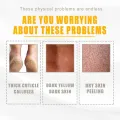 ellow Peeling Oil Extra Strength, Super Strength Yellow Peeling Oil Lightening Exfoliating, Butter Peeling for Dark Skin, Body, Face, Dark Spots, Brightening Complexion.