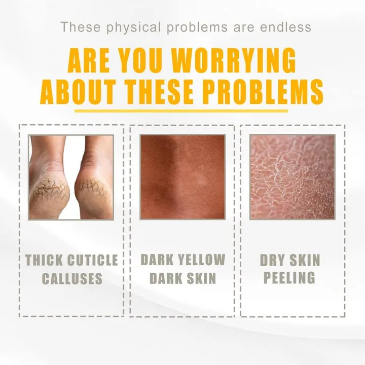 ellow%20Peeling%20Oil%20Extra%20Strength,%20Super%20Strength%20Yellow%20Peeling%20Oil%20Lightening%20Exfoliating,%20Butter%20Peeling%20for%20Dark%20Skin,%20Body,%20Face,%20Dark%20Spots,%20Brightening%20Complexion%20-%20Image%207