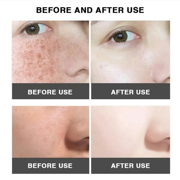 2Pcs%20Remove%20Black%20Skin%20Face%20Cream%20Vaseline%20Vitamin%20E%20Cream%20Set%20Whitening%20Moisturizing%20Nourishing%20Repair%20Cream%20Women%20Skin%20Care%20-%20Image%205