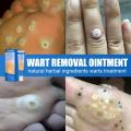 【Best value for money】 New 1 Foot Care Medical Corn Removal Pad Wart Thorn Curative Cream Callue Calloity Wart Ointment Treatment Againt Mole kin. 