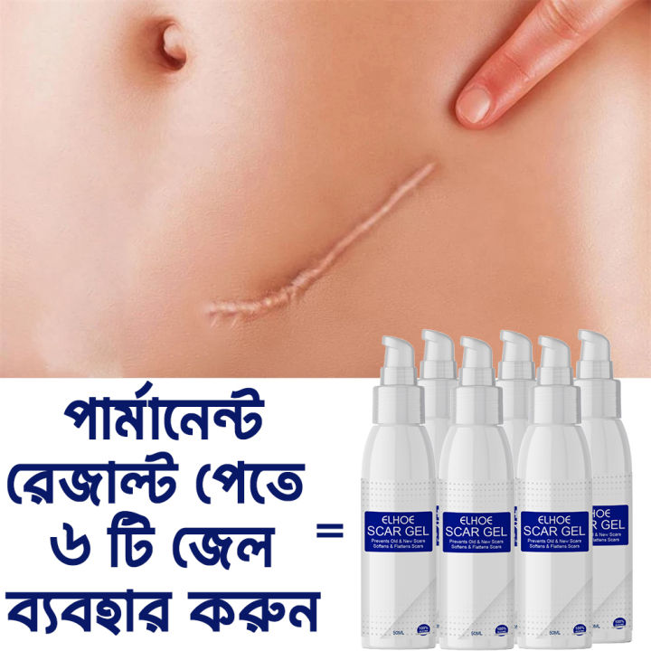 ELHOE%20Scar%20Removal%20Cream%20Gel%20Burn%20Surgical%20Scar%20Cesarean%20Scar%20Repairing%20Stretch%20Marks%20Pigmentation%20Corrector%20-%20Image%203
