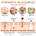 Multi-function Blackhead Remover and Whitehead Remover Device - Acne Pimple Pore Cleaner Vacuum Suction Tool for Men and Women Gently pull dirt and oil out of your skin. 
