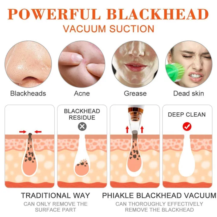 Multi-function%20Blackhead%20Remover%20and%20Whitehead%20Remover%20Device%20-%20Acne%20Pimple%20Pore%20Cleaner%20Vacuum%20Suction%20Tool%20for%20Men%20and%20Women%20Gently%20pull%20dirt%20and%20oil%20out%20of%20your%20skin%20-%20Image%204