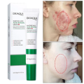 BIOAQUA Salicylic Acid Acne Removal Cream Anti Acne Treatment Repair Marks Moisturizing Blackhead Remover Facial Cream Skin Care-20gm. 