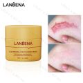 LANBENA Acne Scar Removal Face Treatment Cream Stretch Marks Repair Remove Acne Spots Fade Scar Melanin Moisturizing Smooth Skin-40GM. 