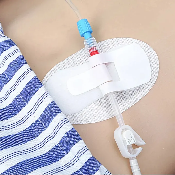 Catheter%20Holder%20Tube%20Sticker%20Bag%20Strap%20Urinary%20Leg%20Legband%20Adhesive%20Urine%20Fixing%20Band%20Device%20Anchor%20G%20Stabilization%20Nephrostomy%20-%20Image%203
