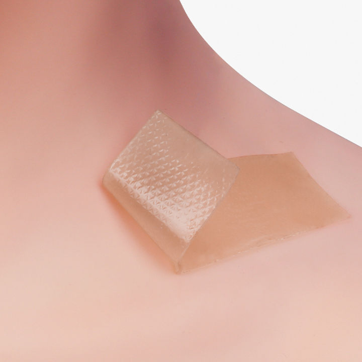 Alexer%20Silicone%20Scar%20Sheet%20-%20Image%203