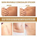 Invisible Concealer Sticker Skin Color Concealer Tattoo Stickers Cover Up Burn Scar Birthmark Invisible Patch Waterproof Tape. 
