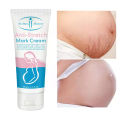 Aichun Beauty Anti Stretch Mark Scar Removal Cream. 