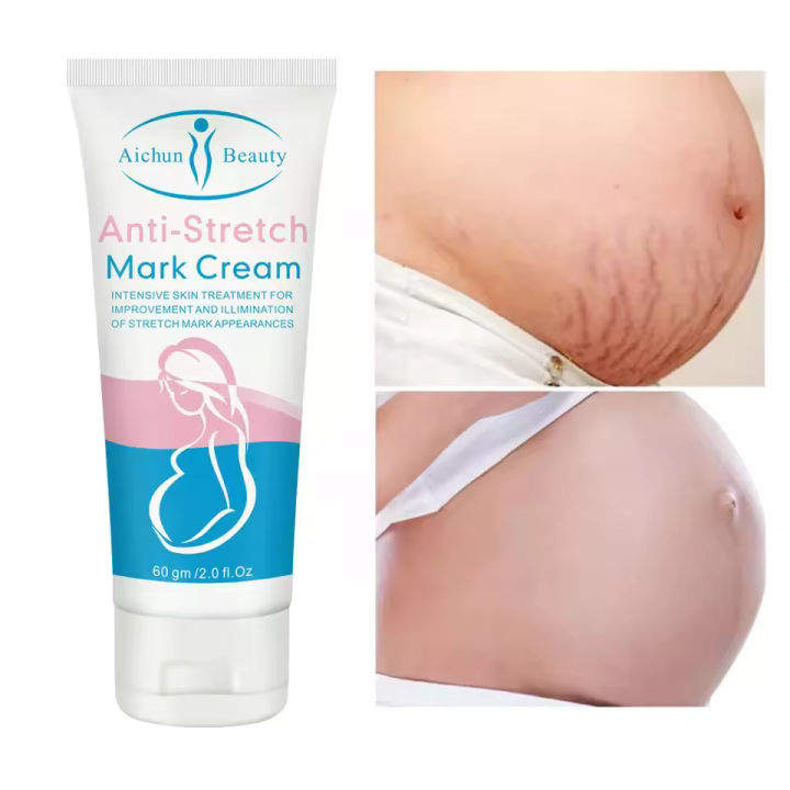 Aichun%20Beauty%20Anti%20Stretch%20Mark%20Scar%20Removal%20Cream%20-%20Image%203