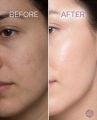 BioCare Retinol+C Anti-aging Serum. 