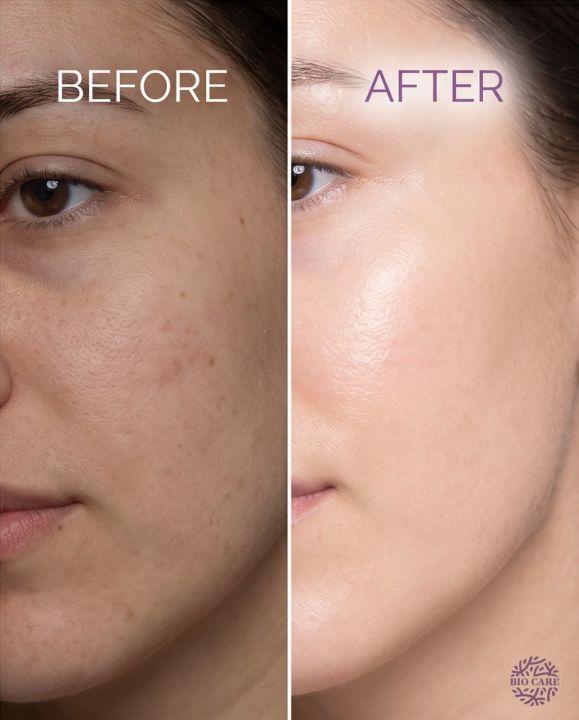 BioCare%20Retinol+C%20Anti-aging%20Serum%20-%20Image%208
