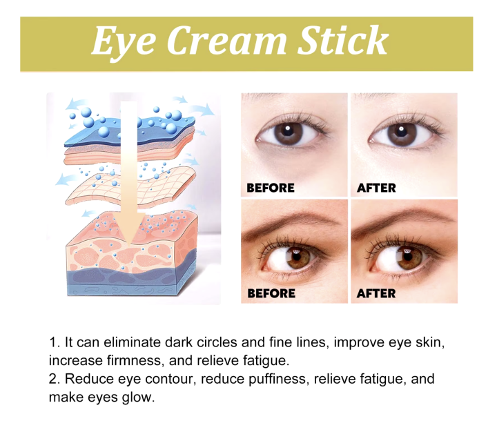Ouhoe%20Anti%20Wrinkle%20Snail%20Peptide%20Eye%20Care%20Cream%20Stick%203gm%20Reduces%20Dark%20Eye%20Circles%20and%20Fine%20Lines%20-%20Image%206