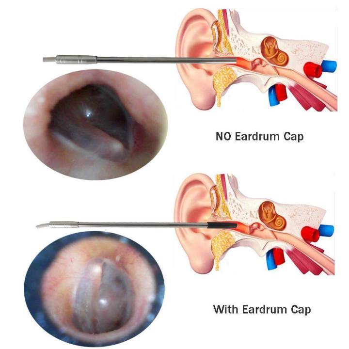 5mm%20Lens%20Android%20OTG%20USB%20/%20PC%20USB%20LED%20Endoscope%20Camera%20Inspection%20Borescope%20Camera%20For%20Ear%20Nose%20Mouse%20-%20Image%204