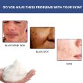 50ml Whitening Facial Cleanser Amino Acid Foam Scrub Cleansing Anti-Acne Oil Control Blackhead Remover Moisturizing Brightening. 