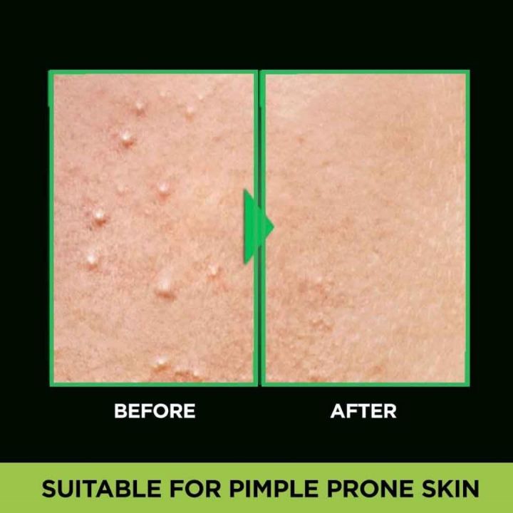 100%20ml%20Garnier%20Men%20Acno%20Fight%20Anti-Pimple%20face%20wash%20Indian%20product%20-%20Image%202