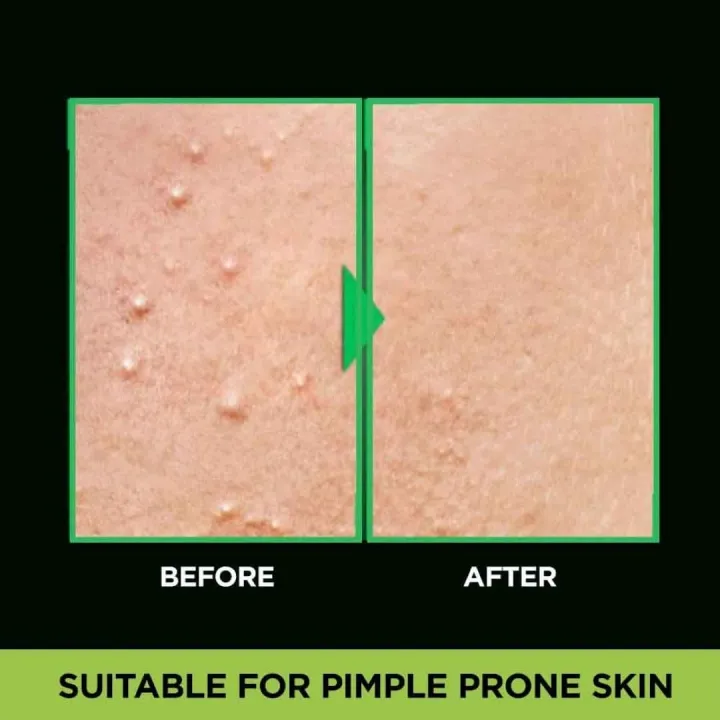 50%20ml%20Garnier%20Men%20Acno%20Fight%20Anti-Pimple%20face%20wash%20Indian%20product%20-%20Image%203