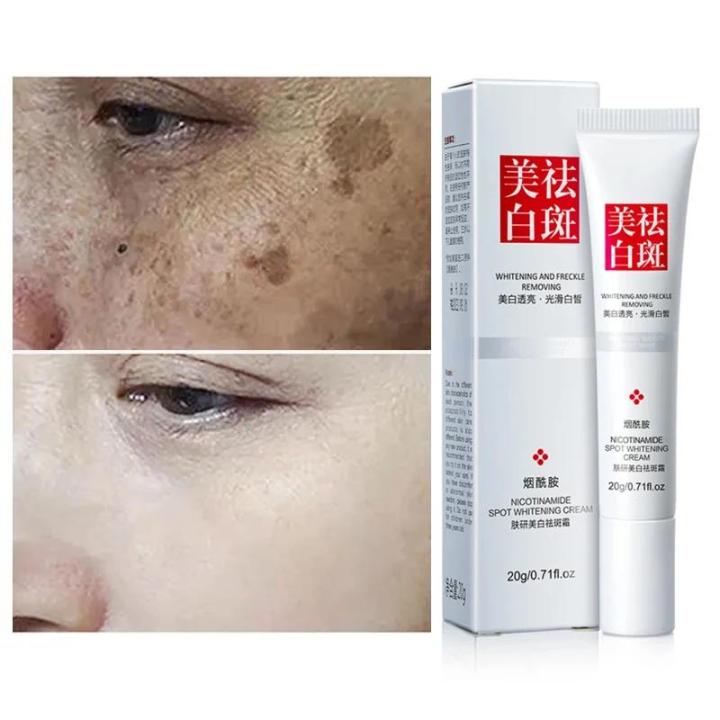Whitening Cream Effective Brightening Remove Yellowish Brown Spots Improve Facial Hyperpigmentation Dull Skin Skin Cream