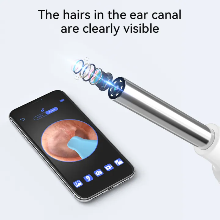 Smart%20Ear%20Wax%20Cleaner%20with%20Camera%203.5mm%20Earpick%20Otoscope%20Visual%20Ear%20Camera%20Health%20Care%20Ear%20Cleaner%20for%20iPhone,%20iPad,%20Android%20-%20Image%202