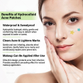 Star-Shaped Acne Patches – Colorful & Cute Pimple Care Solution. 