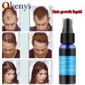 4pcs 30ml Ginger Hair Growth Spray Yuda Pilatory Faster Hair Growth Products for Men and Woman Special for Postpartum Hair Loss. 