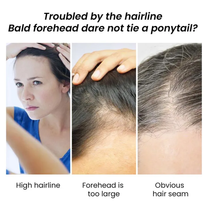 EELHOE%20Hair%20Growth%20Oil%20JOJOBA%20Essential%20Serum%20Anti%20Hair%20Loss%20Fast%20Regrowth%20Scalp%20Treatment%20Moisturizing%20Smooth%20Hair%20Care%20Product%20-%20Image%203