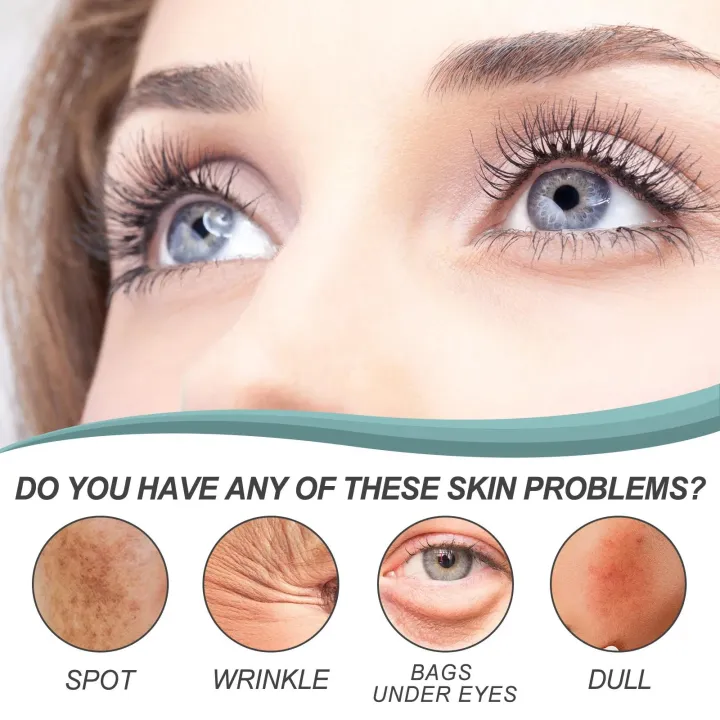 EELHOE%20Dark%20Spot%20Remover%20Cream%20Melasma%20Correction%20Freckle%20Removing%20Anti-Aging%20Brightening%20Freckles%20Anti%20Wrinkle%20Whitening%20Cream%20-%20Image%204