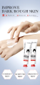 Sadoer Kojic Acid + Niacinamide+ Hyaluronic Acid Whiten Tender Hand Cream Lotion 30ml Korean Moisturizing & Whitening All Skin Portable Hand Care Cream.