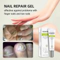 Efero Nail Repair Treatment Gel Fungus Cream-20gm. 
