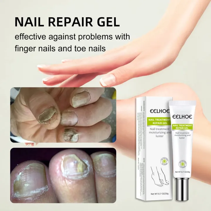Efero%20Nail%20Cream%20Treatment%20Repair%20Gel%20and%20Luster%20-20gm%20-%20Image%203