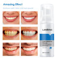 （NEW） Teeth Whitening Toothpaste Tooth-Cleaning Mousse Shining Tooth Whitening Dental Tool Cleaning White Teeth Oral Hygiene Toothpaste Bleaching Remove Stains Mousse 60ml. 