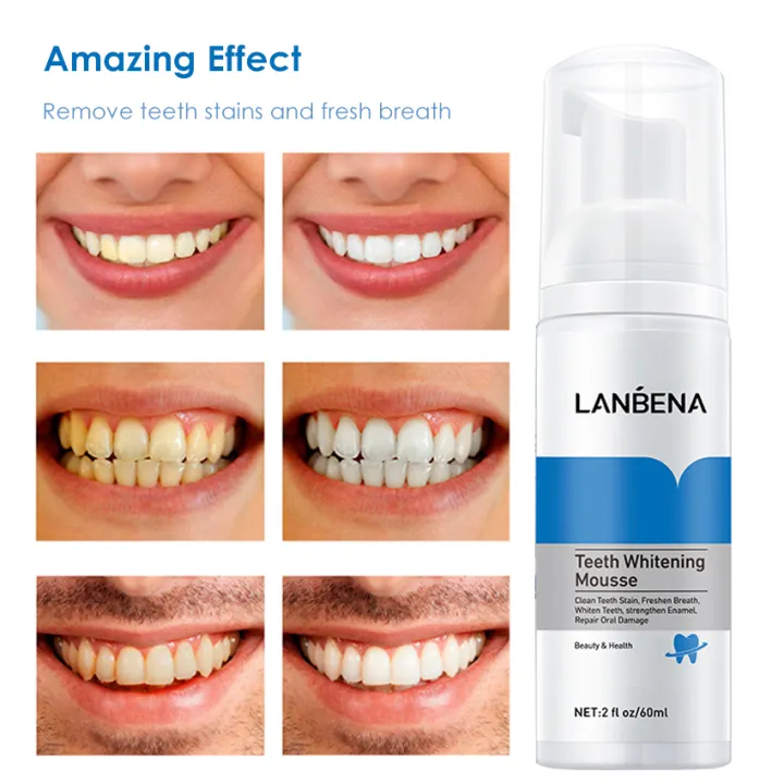 %EF%BC%88NEW%EF%BC%89%20Teeth%20Whitening%20Toothpaste%20Tooth-Cleaning%20Mousse%20Shining%20Tooth%20Whitening%20Dental%20Tool%20Cleaning%20White%20Teeth%20Oral%20Hygiene%20Toothpaste%20Bleaching%20Remove%20Stains%20Mousse%2060ml%20-%20Image%207