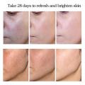Face Dark Spots Remover for Women Remove Melasma Freckles Cream Removal Melanin Whitening Cream Fade Spots Skin Brightening Care.