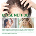Hair Follicle Cream Treat Scalp Hair Folliculitis Skin Inflammation Cysts Papules Spot Remover Body Acne Anti Itching Ointment. 