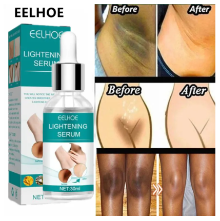 EELHOE Makes Brighter To Your Body And Posture Without Any Side Effect
