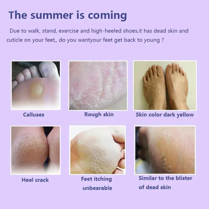 1Pair%20Super%20Exfoliating%20Foot%20Sock%20For%20Pedicure%20Sosu%20Socks%20Peeling%20Cuticle%20Dead%20Skin%20Feet%20Mask%20Moisturizing%20Socks%20Foot%20Care%20Tools%20-%20Image%204