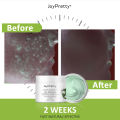 Acne Treatment Facial Mask Natural Tea Tree Pore Cleaning Blackhead Remove Oil Control Pimple Skin Care Products Face Clay Mask KKhao.