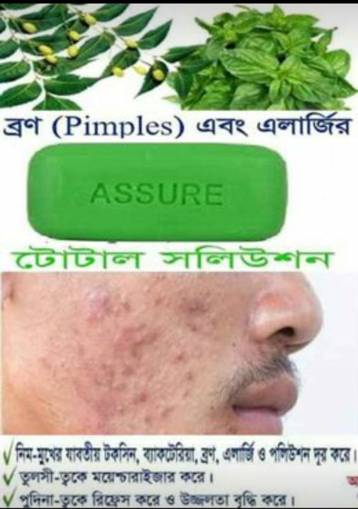 Assure%20Neem%20Pudina%20Tulsi%20Soap%20100g%201p%20BD.%20-%20Image%207