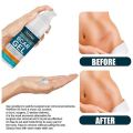Jaysuing Advanced Scar Gel, Scar Removal for Surgical Scars, Acne Scar Removal Cream-50gm. 