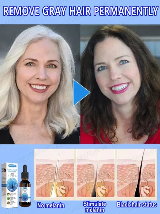 White%20hair%20killer,%20remove%20gray%20hair%20and%20restore%20natural%20hair%20color%20in%207%20days%20-%20Image%204
