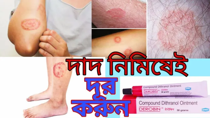 Derobin%20Ointment%2030g%20Indian%20-%20Image%204