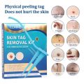 Auto Skin Tag Remover Double Head Wart Removal Pen Set Mole Warts Skin Blemishes Painless Cleaning Skin Care Tools Home Use.